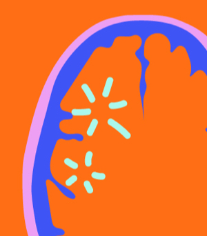 brain illustration related to investigational medicines for qualified individuals in the early access program